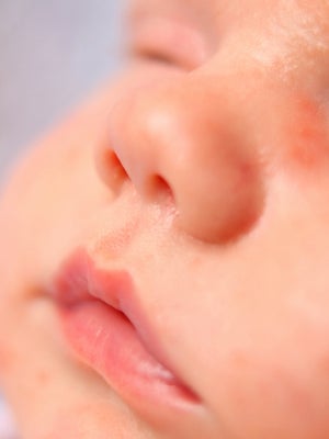 symptom-subpage-09-baby-swelling